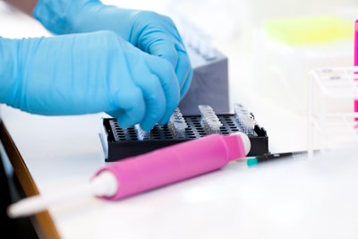 Gloved hands poking with pipette tips. Photo.
